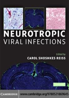 Neurotropic Viral Infections