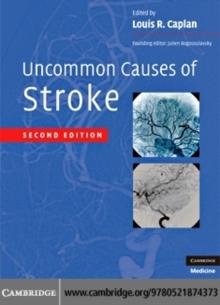 Uncommon Causes of Stroke