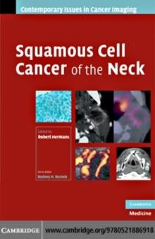 Squamous Cell Cancer of the Neck