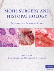 Mohs Surgery and Histopathology : Beyond the Fundamentals