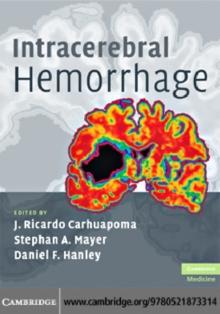 Intracerebral Hemorrhage