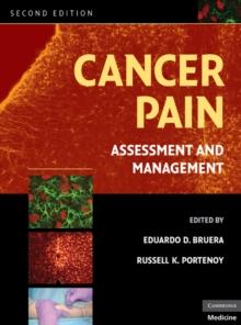 Cancer Pain : Assessment and Management