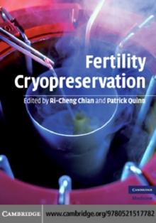 Fertility Cryopreservation