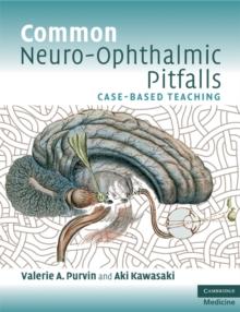 Common Neuro-Ophthalmic Pitfalls : Case-Based Teaching