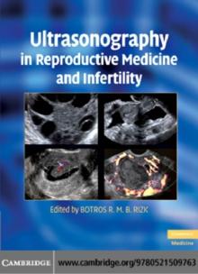 Ultrasonography in Reproductive Medicine and Infertility