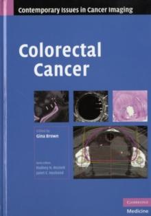 Colorectal Cancer