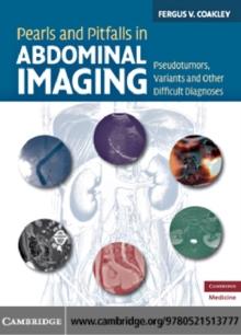 Pearls and Pitfalls in Abdominal Imaging : Pseudotumors, Variants and Other Difficult Diagnoses