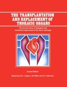 The Transplantation and Replacement of Thoracic Organs : The Present Status of Biological and Mechanical Replacement  of the Heart and Lungs