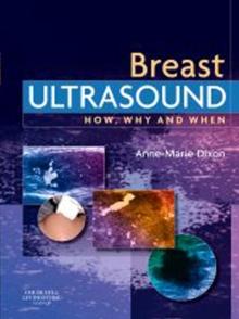 E-Book - Breast Ultrasound : E-Book - Breast Ultrasound