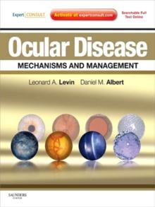 Ocular Disease: Mechanisms and Management : Expert Consult - Online and Print