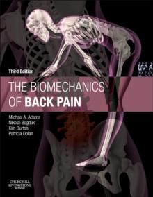 The Biomechanics of Back Pain - E-Book