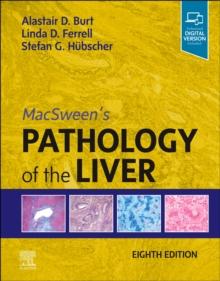 MacSween's Pathology of the Liver, E-Book