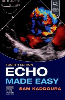 Echo Made Easy , E-Book : Echo Made Easy , E-Book