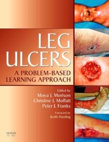 Leg Ulcers E-Book : Leg Ulcers E-Book