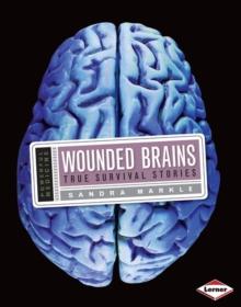 Wounded Brains : True Survival Stories