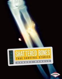 Shattered Bones : True Survival Stories