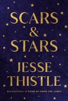 Scars And Stars : Poems