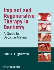 Implant and Regenerative Therapy in Dentistry : A Guide to Decision Making