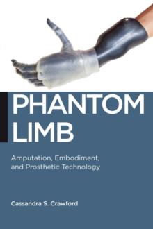 Phantom Limb : Amputation, Embodiment, and Prosthetic Technology