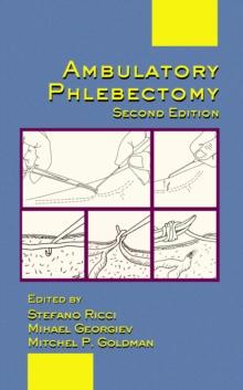 Ambulatory Phlebectomy