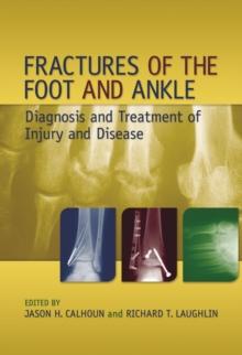 Fractures of the Foot and Ankle : Diagnosis and Treatment of Injury and Disease