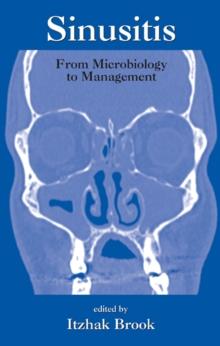 Sinusitis : From Microbiology To Management