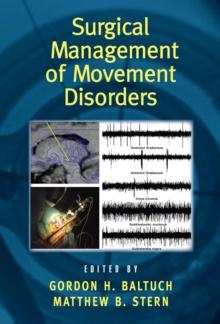 Surgical Management of Movement Disorders