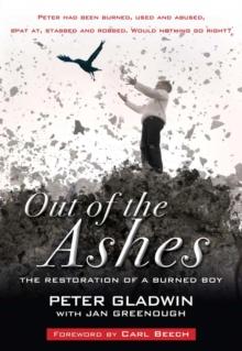 Out of the Ashes : The restoration of a burned boy