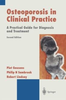 Osteoporosis in Clinical Practice : A Practical Guide for Diagnosis and Treatment