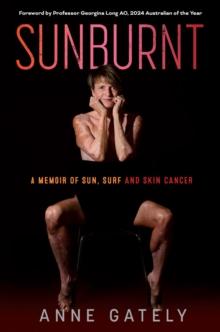 SUNBURNT : A memoir of sun, surf and skin cancer