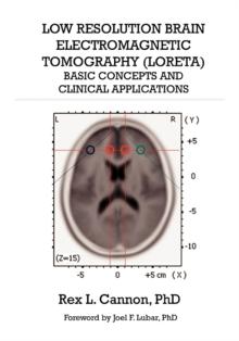 Low Resolution Brain Electromagnetic Tomography (Loreta) : Basic Concepts and Clinical Applications