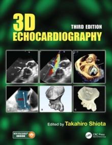 3D Echocardiography