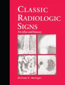 Classic Radiologic Signs : An Atlas and History