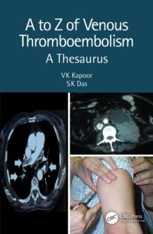 A to Z of Venous Thromboembolism : A Thesaurus