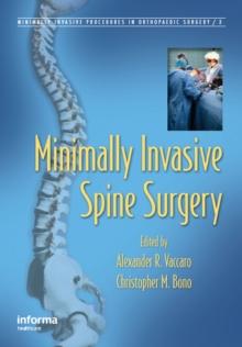 Minimally Invasive Spine Surgery