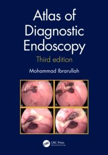 Atlas of Diagnostic Endoscopy, 3E