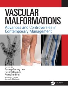 Vascular Malformations : Advances and Controversies in Contemporary Management