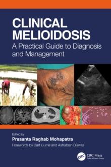 Clinical Melioidosis : A Practical Guide to Diagnosis and Management