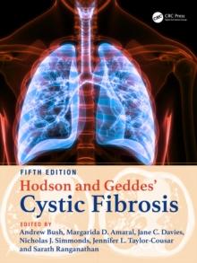 Hodson and Geddes' Cystic Fibrosis