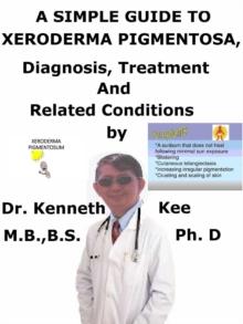 Simple Guide to Xeroderma Pigmentosa, Diagnosis, Treatment and Related Conditions