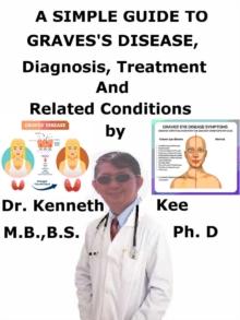 Simple Guide to Graves's Disease, Diagnosis, Treatment and Related Conditions