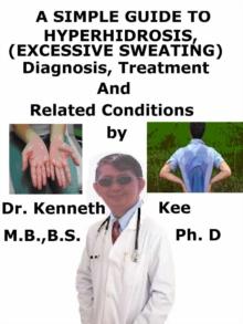 Simple Guide to Hyperhidrosis, (Excessive Sweating) diagnosis, Treatment and Related Conditions