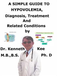 Simple Guide to Hypovolemia, Diagnosis, Treatment and Related Conditions