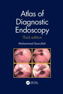 Atlas of Diagnostic Endoscopy, 3E