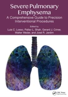 Severe Pulmonary Emphysema: : A Comprehensive Guide to Precision Interventional Procedures