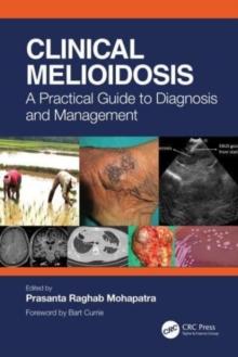 Clinical Melioidosis : A Practical Guide to Diagnosis and Management