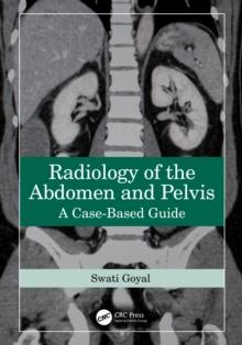 Radiology of the Abdomen and Pelvis : A Case-Based Guide