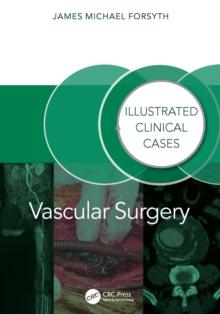 Vascular Surgery: : Illustrated Clinical Cases