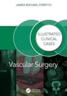 Vascular Surgery: : Illustrated Clinical Cases