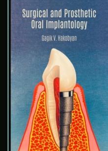 Surgical and Prosthetic Oral Implantology